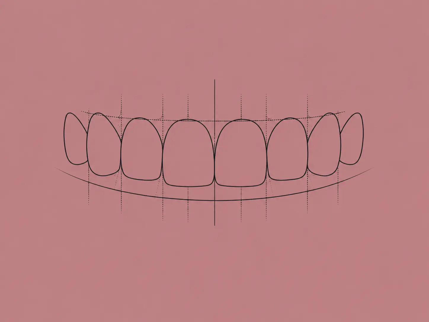 smile design – art du sourire smile design - art du sourire
